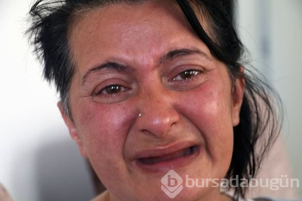 Aynaya baktığında ölmek istiyordu! Bir de şimdi görün...
