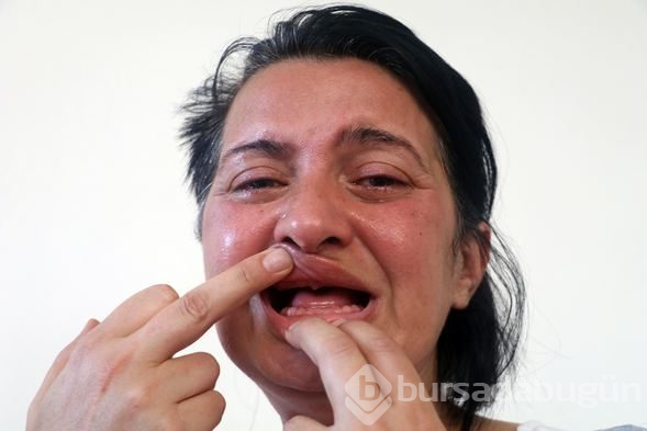 Aynaya baktığında ölmek istiyordu! Bir de şimdi görün...
