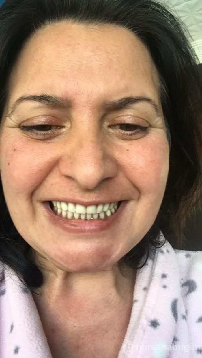 Aynaya baktığında ölmek istiyordu! Bir de şimdi görün...
