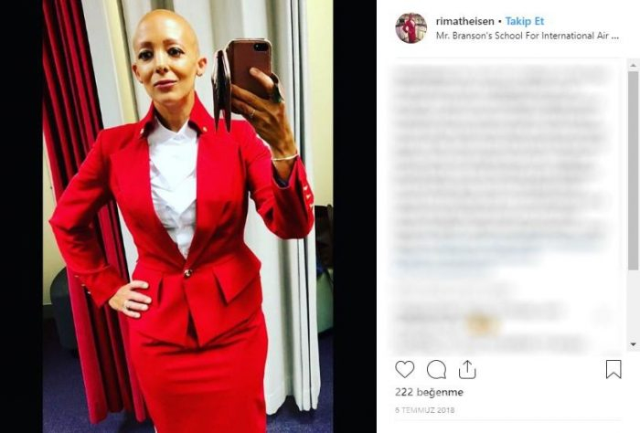 Saçları bir anda bu hale geldi! Kanser olduğunu düşündü ama...
