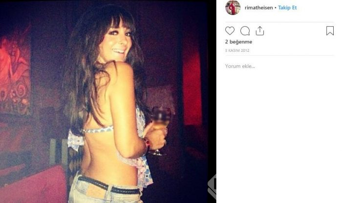 Saçları bir anda bu hale geldi! Kanser olduğunu düşündü ama...
