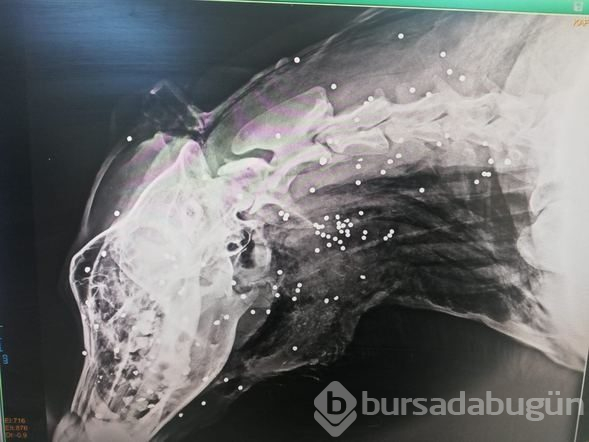 Röntgeni çekilince dehşet ortaya çıktı! İnsanların yüzüne bakamıyor

