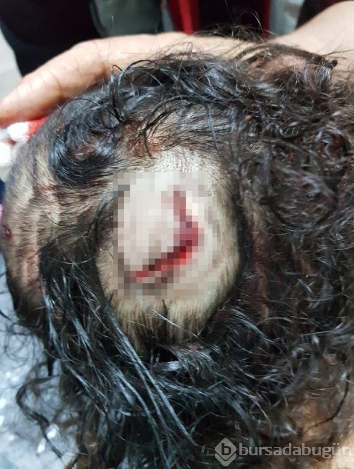 Rottweiler'ın saldırdığı 2 yaşındaki Almila ölümden döndü
