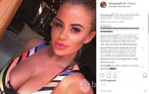 Chloe Ayling kaçırılıp işkence gördü! Tek tek anlatacak
