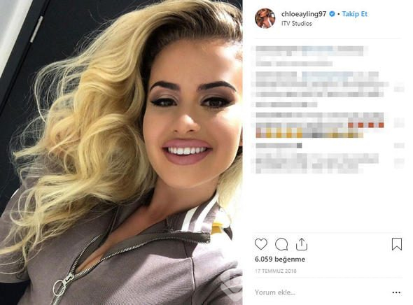 Chloe Ayling kaçırılıp işkence gördü! Tek tek anlatacak
