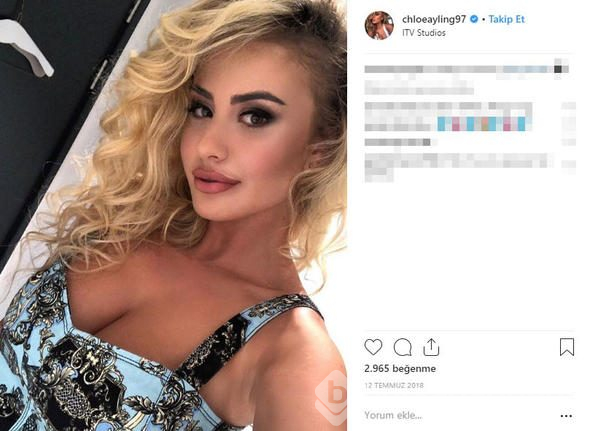 Chloe Ayling kaçırılıp işkence gördü! Tek tek anlatacak
