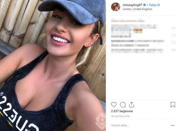 Chloe Ayling kaçırılıp işkence gördü! Tek tek anlatacak
