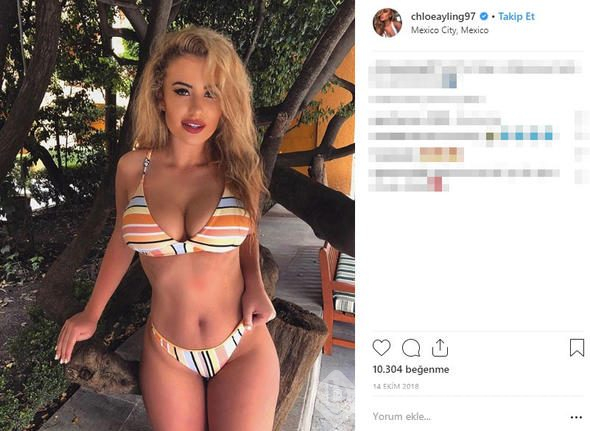Chloe Ayling kaçırılıp işkence gördü! Tek tek anlatacak

