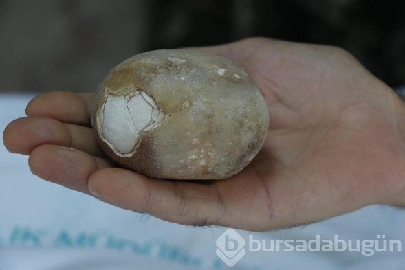 Doktorlar şoke oldu: Görünce patates sandım
