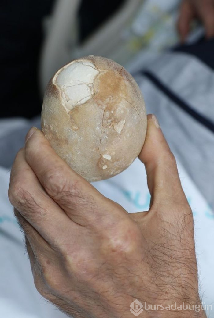 Doktorlar şoke oldu: Görünce patates sandım
