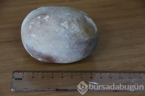 Doktorlar şoke oldu: Görünce patates sandım
