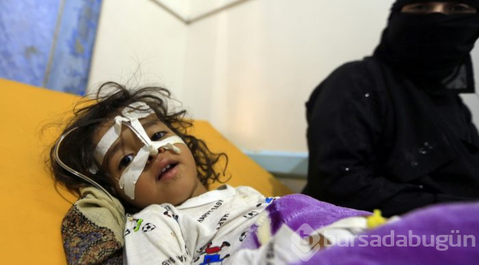 Yemen'de kolera salgınından ölenlerin sayısı 190'a yükseldi
