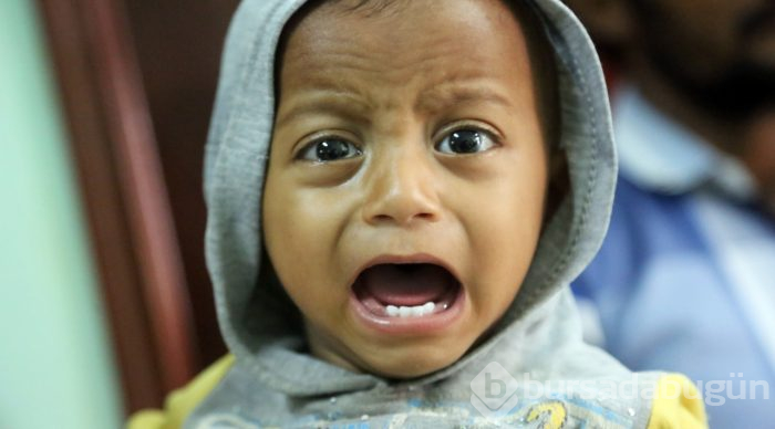 Yemen'de kolera salgınından ölenlerin sayısı 190'a yükseldi
