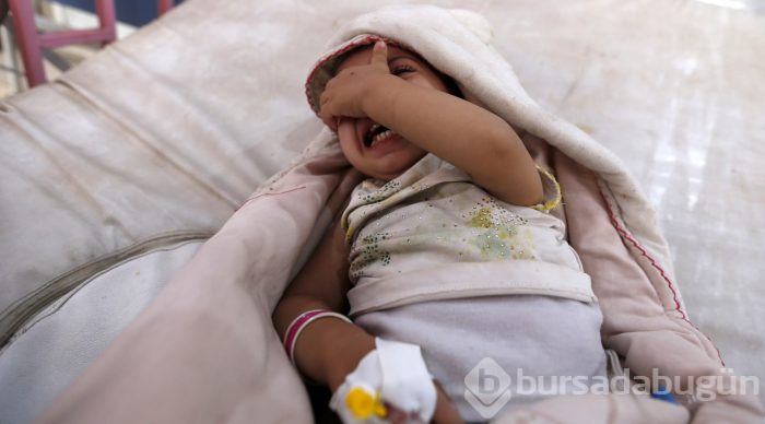 Yemen'de kolera salgınından ölenlerin sayısı 190'a yükseldi
