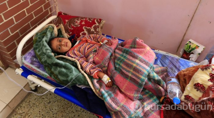 Yemen'de kolera salgınından ölenlerin sayısı 190'a yükseldi
