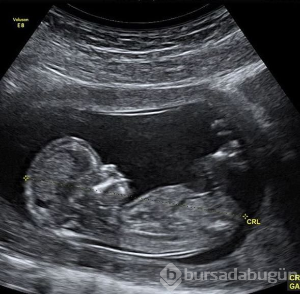 Justin Bieber baba oluyor!
