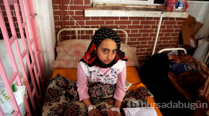 Yemen'deki kolera salgını
