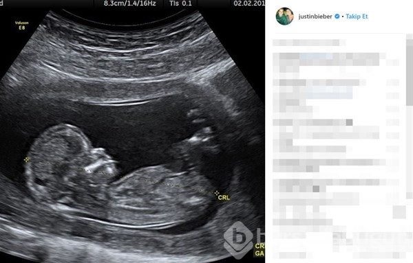 Romantik Bieber...
