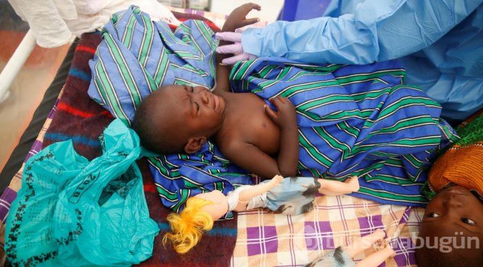 Kongo Demokratik Cumhuriyeti'nde ebola ölümleri artıyor
