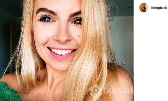 38 kiloya düşmüştü o şimdi bambaşka birine dönüştü!
