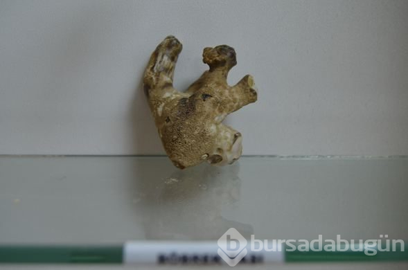  Hastalardan çıkan böbrek taşlarından sergi yaptılar 