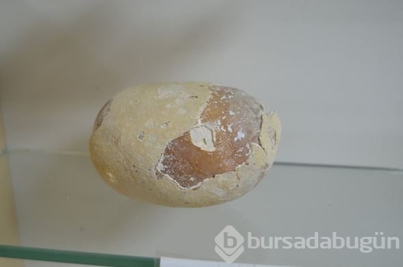  Hastalardan çıkan böbrek taşlarından sergi yaptılar 