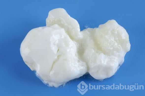 Probiyotiklerin vücudumuza 5 önemli etkisi!

