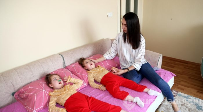 Hasta ikizlerin ailesi yardım bekliyor

