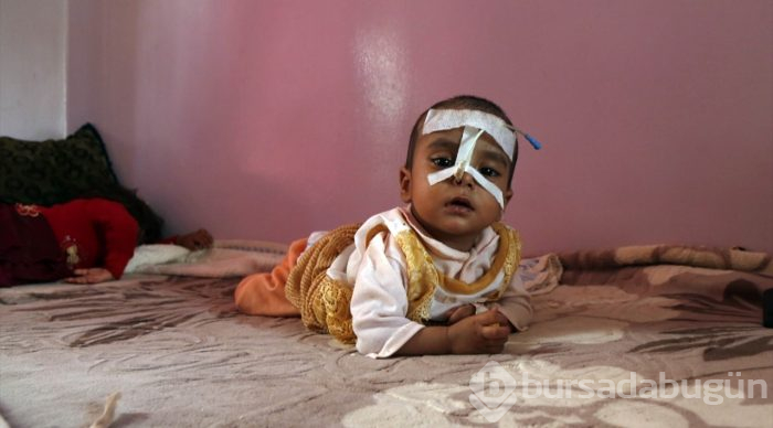 Yemen'deki insani kriz
