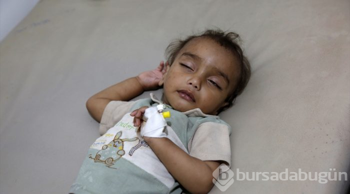 Yemen'deki insani kriz
