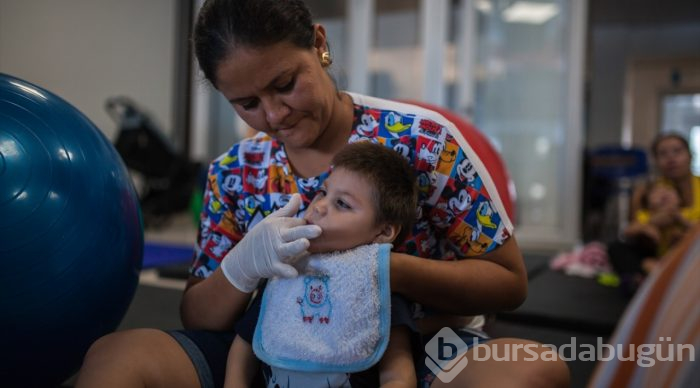 Kolombiya'da Zika Virüslü Nesil - Mikrosefali

