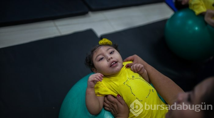 Kolombiya'da Zika Virüslü Nesil - Mikrosefali
