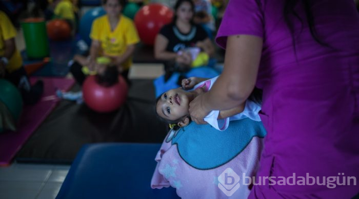 Kolombiya'da Zika Virüslü Nesil - Mikrosefali

