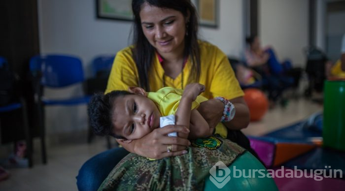 Kolombiya'da Zika Virüslü Nesil - Mikrosefali
