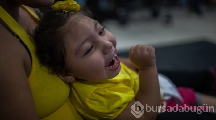 Kolombiya'da Zika Virüslü Nesil - Mikrosefali
