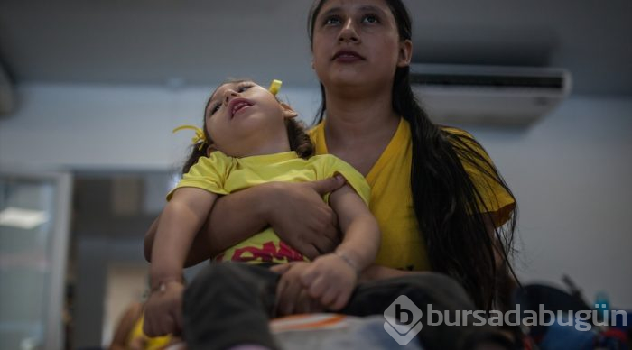 Kolombiya'da Zika Virüslü Nesil - Mikrosefali
