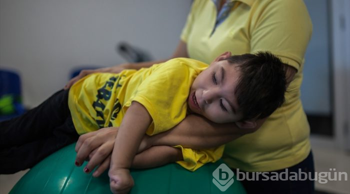 Kolombiya'da Zika Virüslü Nesil - Mikrosefali
