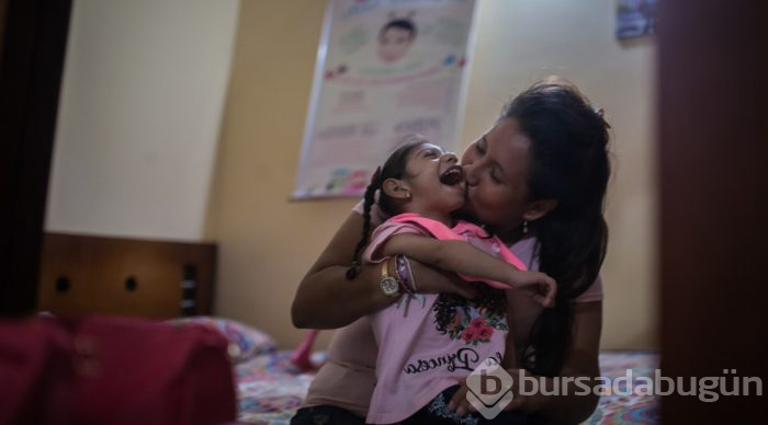 Kolombiya'da Zika Virüslü Nesil - Mikrosefali
