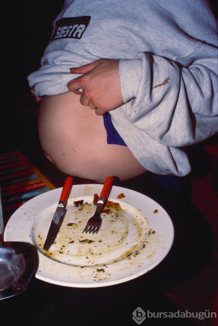 Obeziteye neden olan 10 risk faktörü (22 Mayıs Dünya Obezite Günü)
