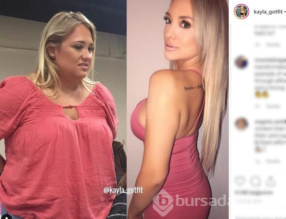 Kayla aşırı kilolarından kurtuldu, şimdi bambaşka biri
