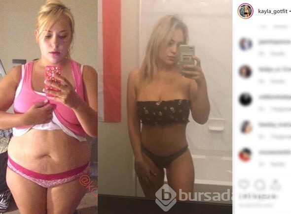Kayla aşırı kilolarından kurtuldu, şimdi bambaşka biri

