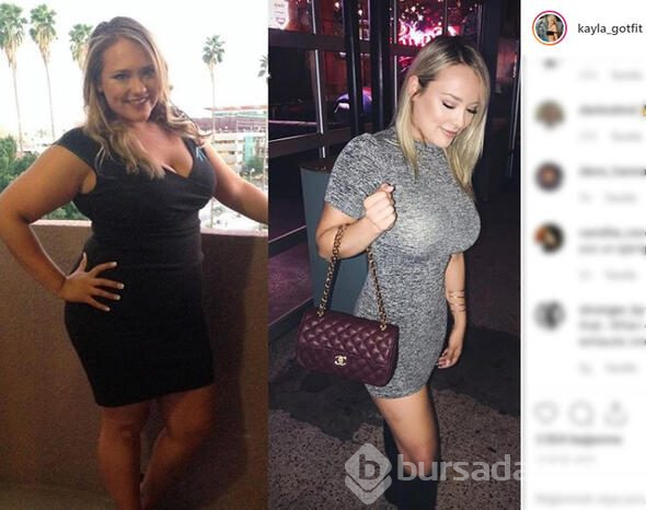 Kayla aşırı kilolarından kurtuldu, şimdi bambaşka biri

