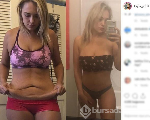 Kayla aşırı kilolarından kurtuldu, şimdi bambaşka biri
