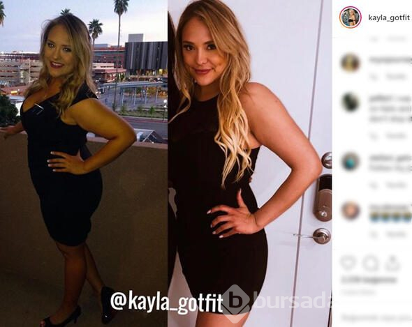 Kayla aşırı kilolarından kurtuldu, şimdi bambaşka biri
