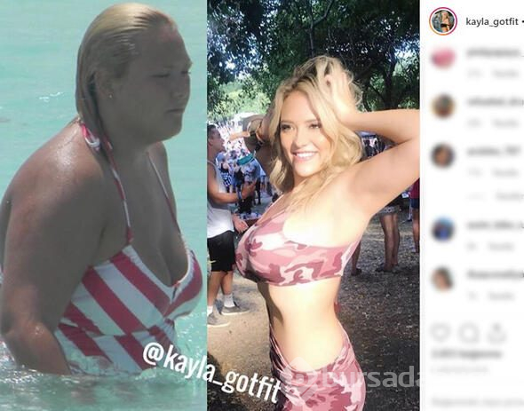 Kayla aşırı kilolarından kurtuldu, şimdi bambaşka biri
