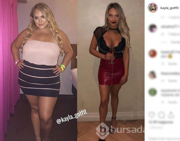 Kayla aşırı kilolarından kurtuldu, şimdi bambaşka biri
