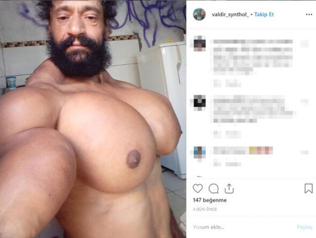 Sosyal medyada tartışma yarattı! Doktorlar uyarıyor