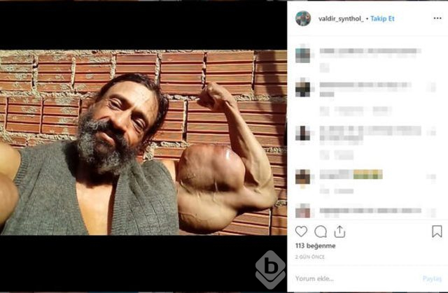 Sosyal medyada tartışma yarattı! Doktorlar uyarıyor