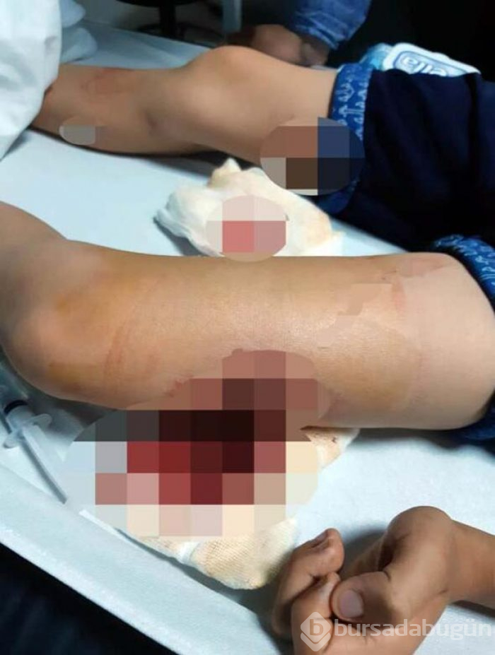 Husumet yaşadığı bir ailenin çocuğunu vurmak isterken başka bir çocuğa ateş etti