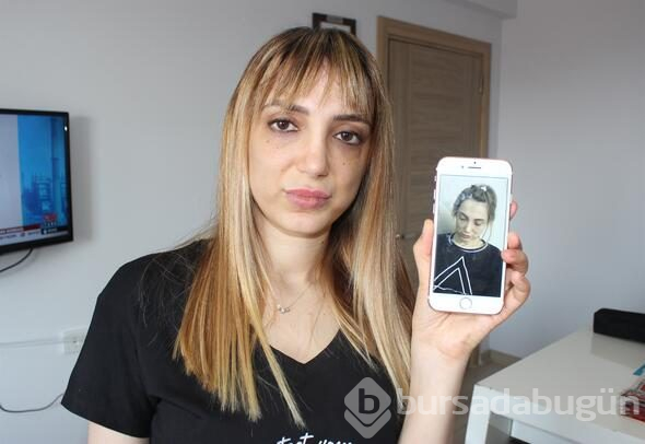 Estetik mağduru kadının yüzü tanınmaz hale geldi